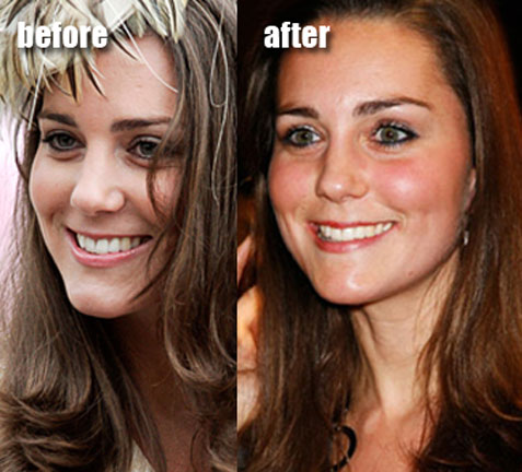 kate middleton weight loss pictures. kate middleton weight loss.